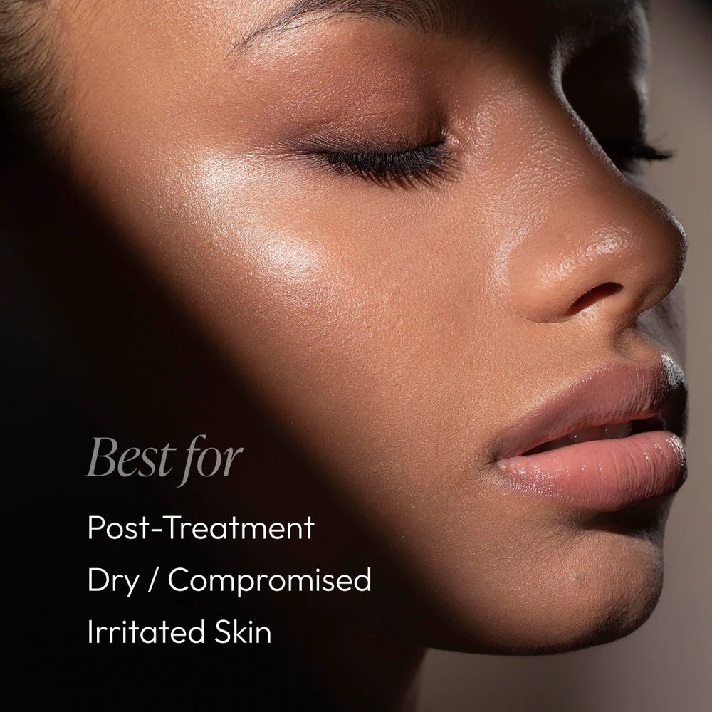 Post Treatment Balm